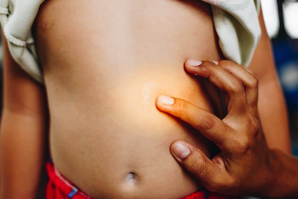 How Long Do Sand Flea Bites Last The Facts You Need to Know 3 How Long Do Sand Flea Bites Last The Facts You Need to Know 3